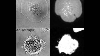 Isotropic and anisotropic spreading of fibroblasts [upl. by Eiramnwad699]