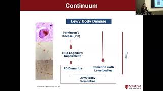 Lewy Body Dementia Overview  Dr Kathleen Poston LBD Caregiving Symposium [upl. by Lu689]