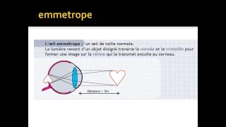 OPHTALMOLOGIE Œil et Vices de Réfraction [upl. by Adiasteb]