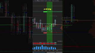 How to read a footprint chart orderflow daytrading scalping [upl. by Na496]