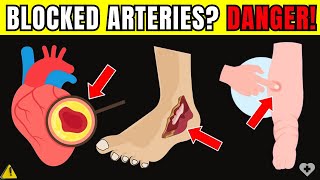 🛑 Heart Alert 7 Signs of Blocked Arteries in Legs and Feet That Could Put Your Life at Risk [upl. by Pauly]