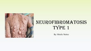 Neurofibromatosis Type 1  definition signs diagnostic criteria management complication [upl. by Marty466]