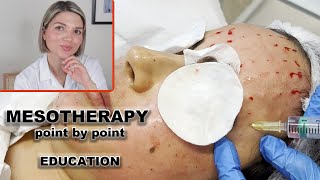 Mesotherapy for face full demo and point by point injection technique [upl. by Deste]