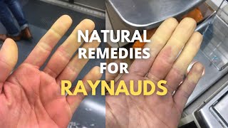 5 natural remedies for RAYNAUDS [upl. by Danila]