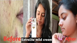 xtralite mild cream Dark spot remover cream  Dailyvlogerpriyanka [upl. by Eiderf]