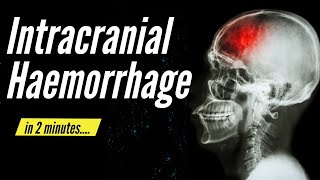 Intracranial Haemorrhage in 2 minutes [upl. by Fuchs]