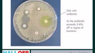 Microbiology resources  How to Measure Zones of Inhibition ZOI [upl. by Olav]