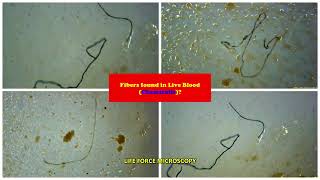 Live Blood FIBERS FOUND IN BLOOD Chemtrails [upl. by Zilber]