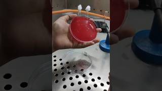 How To Streak For Blood Agar Plates Bacterial Streaking Technique [upl. by Iadam]