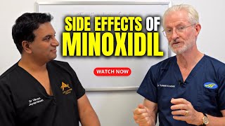 Side Effects of Minoxidil [upl. by Aivek]