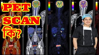 PET Scan কি health doctor rectalbleeding science constipation rectalcancer [upl. by Aiyekal]