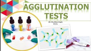 Types of Agglutination tests [upl. by Yuji]