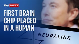 Elon Musks Neuralink company implants brain chip in human for first time [upl. by Nairb]