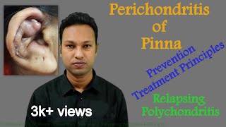 Perichondritis of Pinna Prevention amp Treatment। Difference with Relapsing Polychondritis [upl. by Davey232]