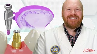 How to take a closed tray implant impression [upl. by Prestige101]