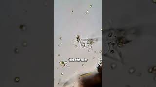 Amebas tentam se juntar e formar uma MEGA AMEBA microorganismos microbiologia curiosidades [upl. by Nassah]