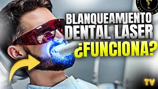 BLANQUEAMIENTO dental LÁSER ¿FUNCIONA [upl. by Ahsilrak]