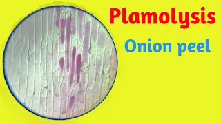 To study Plasmolysis in epidermal cells of Onion peel  Plasmolysis Slide  Pravin Bhosale [upl. by Maguire]