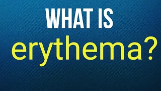 What is erythema [upl. by Nylesoy]