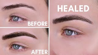 Microblading Experience  Before amp After  10 Day Healing Process [upl. by Nnarefinnej]