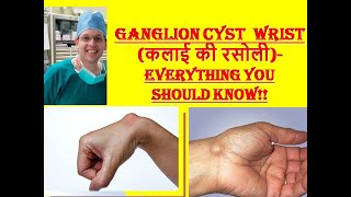 Ganglion Cyst Wrist in Hindiकलाई की सिस्ट कैसे ठीक करेंDr Atul Mahajan [upl. by Shelli]