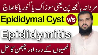 Epididymitis treatment in hindi  Epididymal cyst treatment  sozak Ka ilaj  Epididymitis [upl. by Jo Ann636]