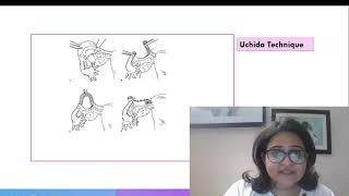 Tubal Ligation  What you need to know for NEET PG [upl. by Nanerb]