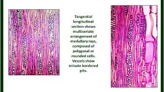 Quassia wood Microscopy  K S Laddha  ICT [upl. by Giff]