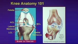 Common Traumatic Knee Injuries Oh My Aching Knee [upl. by Odlopoel]