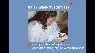 My 17 week Miscarriage  Birth story  Doula support  Memory Box  12 week twin miscarriage [upl. by Spaulding]