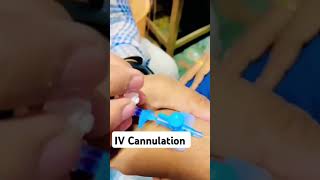 IV Cannulation techniquedoctormedicalstudentMedicalPracticeandTalks [upl. by Oys]