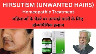 Unwanted Hairs Hirsutismअनचाहे बाल Homeopathic treatment  Natural Healing [upl. by Ahsemaj]