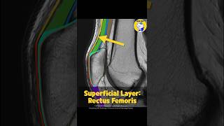 Fig 4B01 Anatomy of the Multilayered Quadriceps Tendon Part 1 [upl. by Hiltan]