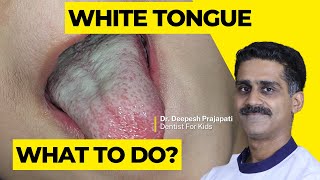 WhiteCoated Tongue  Pediatric Oral Health Tips [upl. by Niobe]