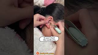 Worried About QTip Dangers Try the Baby Ear Cleaning Tool with Light babycare earwaxremoval [upl. by Amice]