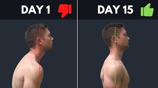 SUPER SIMPLE amp Effective Fix For Rounded Shoulders amp Forward Head Posture [upl. by Repard375]