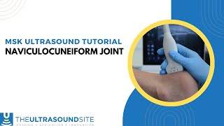 Naviculocuneiform joint NCJ [upl. by Frederico]