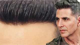 AkshayKumar Hair Patch service for men Delhi Natural lace Hair Wigs Non surgical hair replacement [upl. by Aidaas]