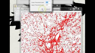 Quantifying Stained Liver Tissue Area Using ImageJ [upl. by Dotty]