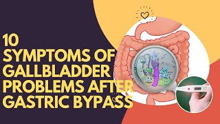 10 Symptoms Of Gallbladder Problems After Gastric Bypass [upl. by Nnalatsyrc]