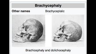 DolichocephalicBasics of AnatomyAnthropology Optional [upl. by Rahab]