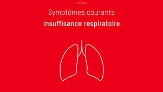 Quels sont les symptômes du Covid19 [upl. by Mccollum]