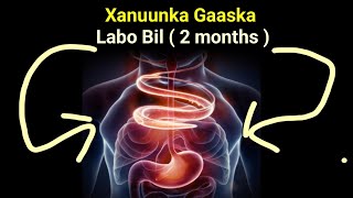 Hadii Xanuunka Gaaska uuku dhibay Raac labo Bil Talada Dr Timajilac  2 months only [upl. by Chemar]