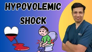 Hypovolemic shock के मरीज की जान कैसे बचाएं Hypovolemic shock in hindi Hypovolemic shock treatment [upl. by Cleodell]