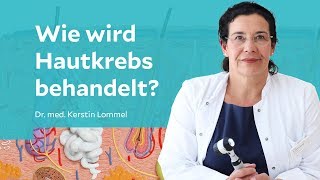 Wie wird Hautkrebs behandelt [upl. by Leone]