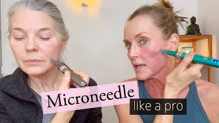 How to SAFELY amp EFFECTIVELY Medical Microneedle  Full Demo Beginner to Advanced amp what to use after [upl. by Eizeerb]