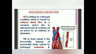 Myocardial Infarction  fully explained in Hindi  Examvila [upl. by Klingel707]