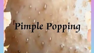 Pimple amp Blackheads Popping  37 [upl. by Nylla]