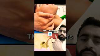 Temporomandibular joint disorder tmjtmjdisorder dentist dental [upl. by Thornburg909]