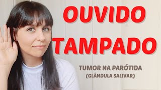 Ouvido tampado  tumor na parótida [upl. by Kellene]